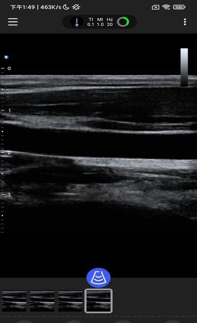 思多科超声  v1.0.0图3